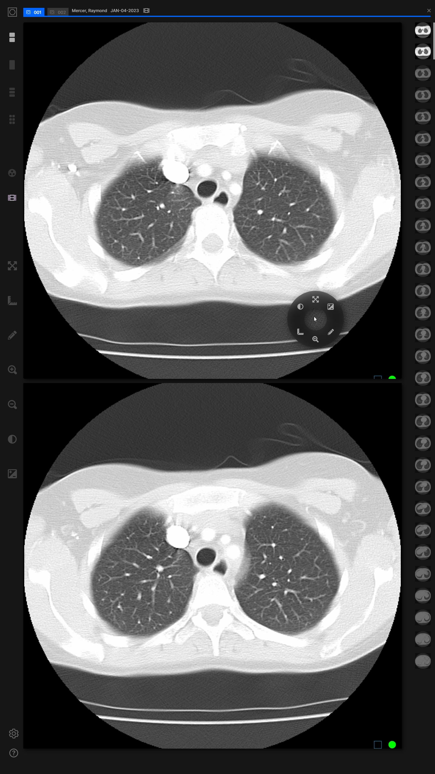 021-Demo-Radiologist-Open-Case-Viewer-Current-Study