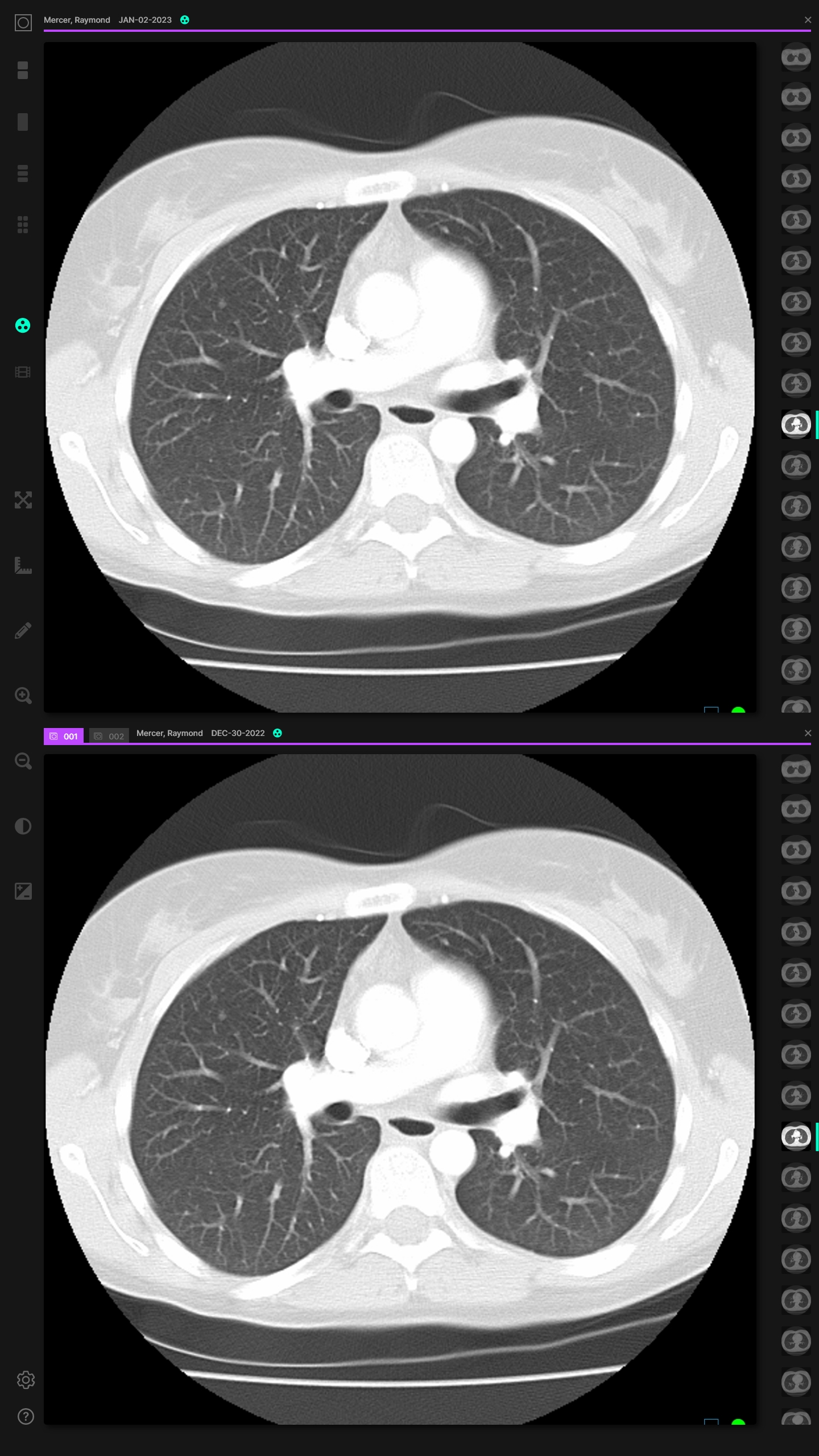 022-Demo-Radiologist-Open-Case-Viewer-Priors